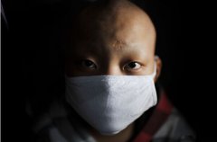 裝修除甲醛，預(yù)防白血病的其中一條途徑